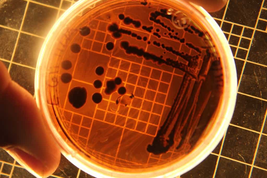 Close-up of bacteria colonies in a petri dish under laboratory conditions. Zeolite benefits good bacteria
