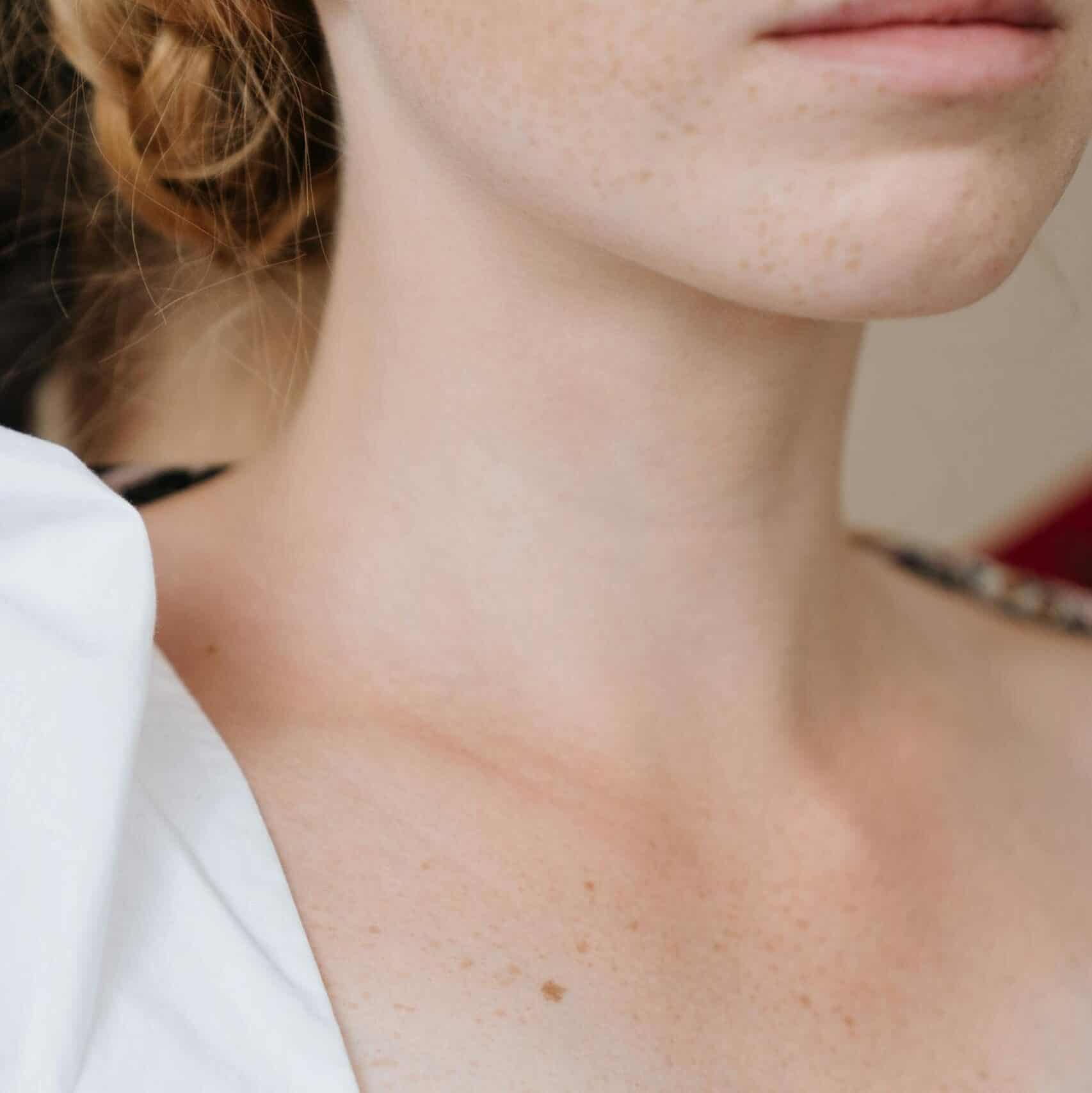An intimate close-up of a woman's neck and shoulder in a white top, highlighting freckles and skin detail.