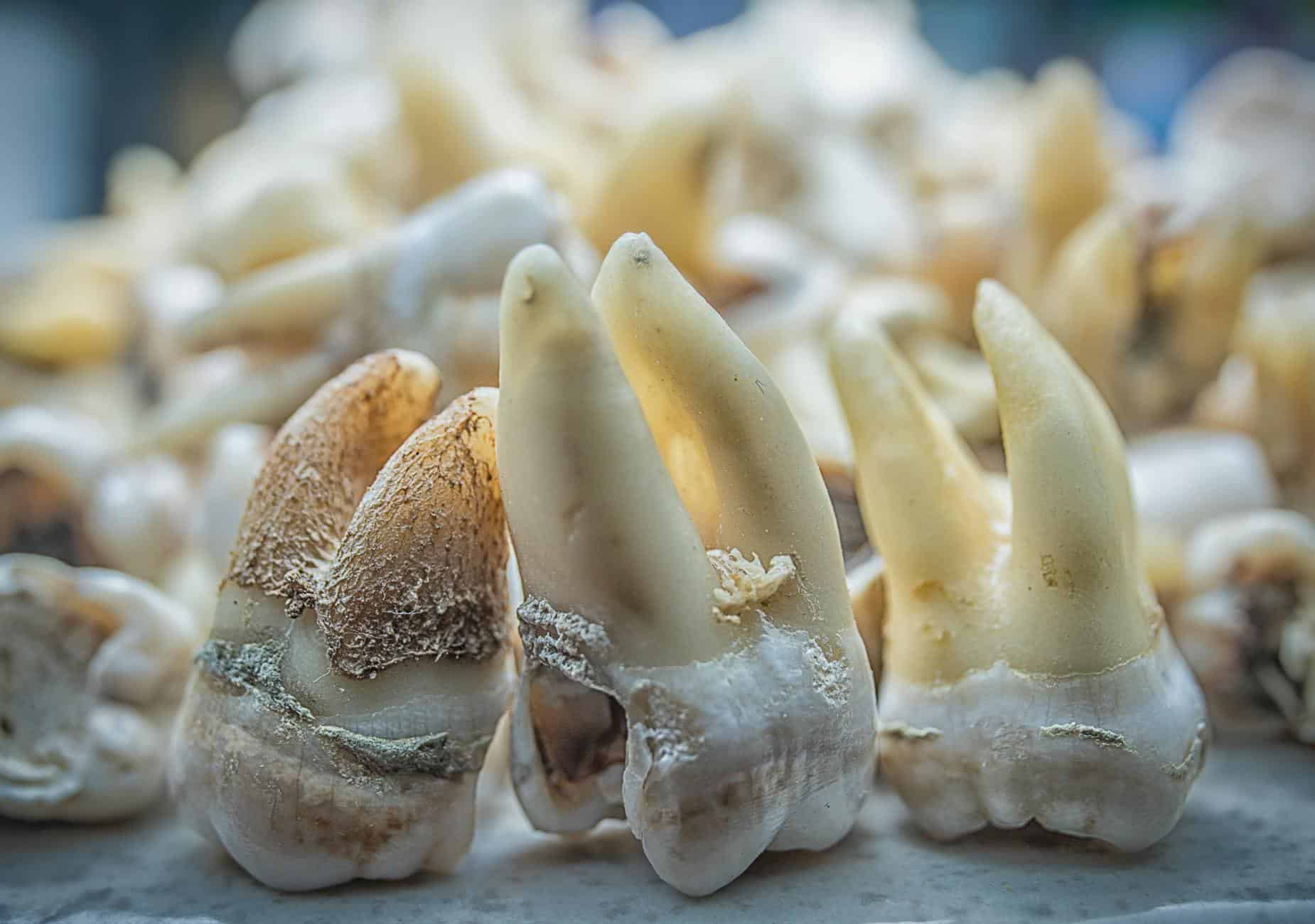 macro close up of decaying human teeth